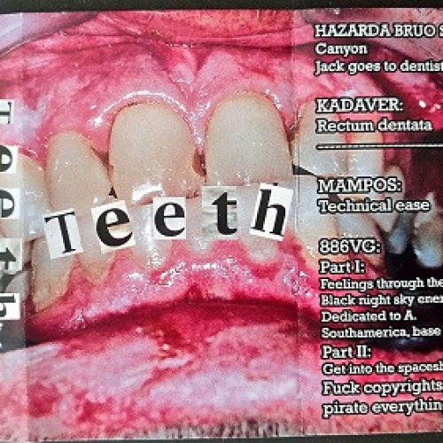 Hazarda Bruo Sonsistemo, Kadaver, Mampos, 886VG – Teeth cassette 2019